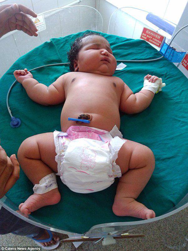 В Индии родилась «самая тяжелая в мире» девочка