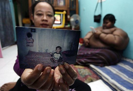 В Индонезии «самого полного в мире ребенка» посадили на диету