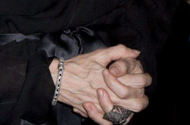 Мадонна показала руки после курса омолаживающих процедур