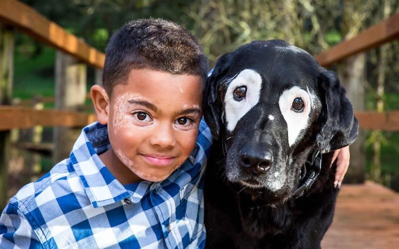 Мальчика и собаку подружила общая болезнь