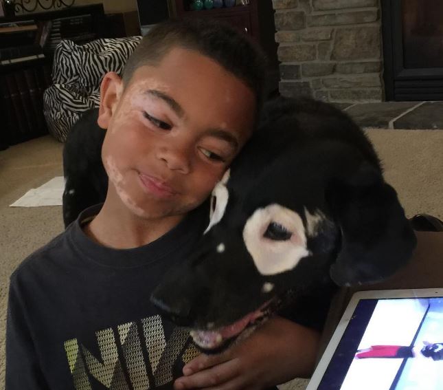 Мальчика и собаку подружила общая болезнь