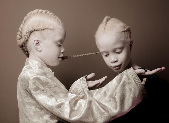 Необычная красота: девочки-альбиносы покорили Сеть