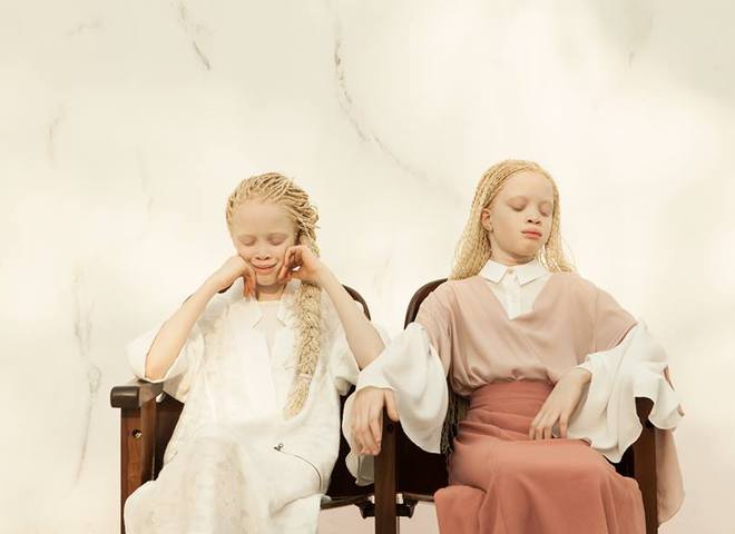 Необычная красота: девочки-альбиносы покорили Сеть