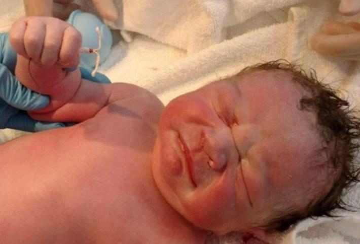 Un nou născut a venit pe lume cu steriletul mamei în mână