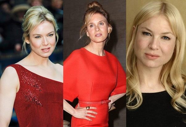 In incercarea de a parea vesnic tanara, Renee Zellweger si-a facut un lifting care i-a distrus fata