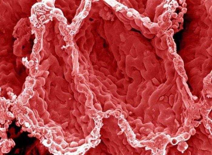18 fotografii uimitoare: Cum arată organele noastre la microscop