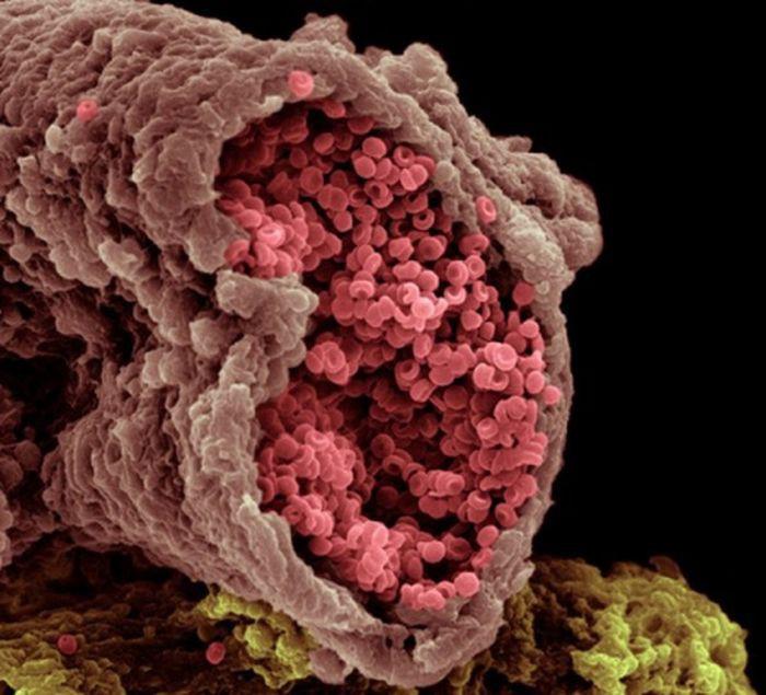 18 невероятных фотографий человеческих органов под микроскопом!