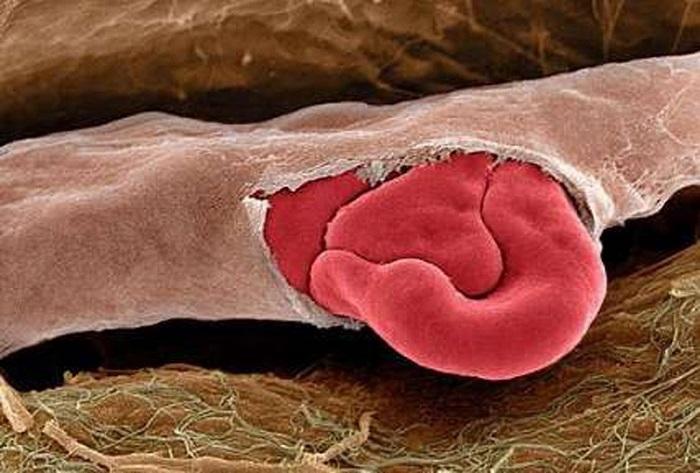18 fotografii uimitoare: Cum arată organele noastre la microscop