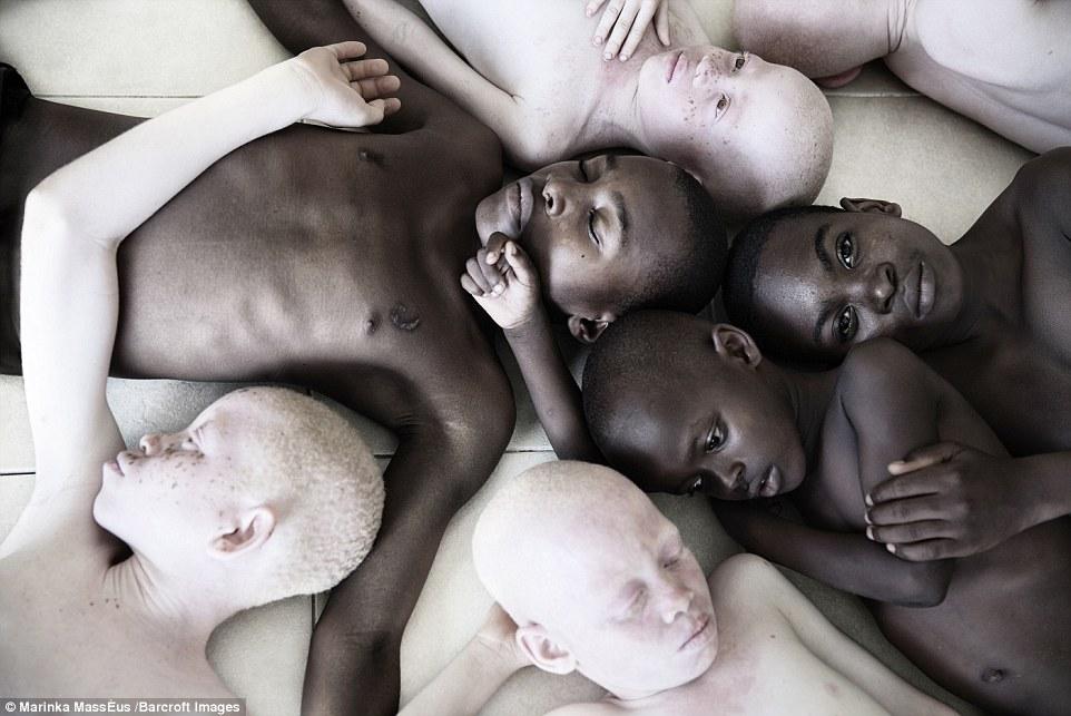 Albinoșii, care sunt mutilați și uciși în Tanzania, într-un proiect foto impresionant