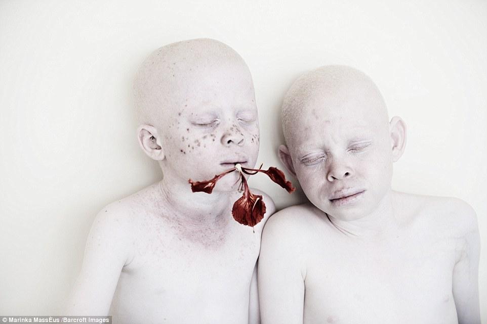 Albinoșii, care sunt mutilați și uciși în Tanzania, într-un proiect foto impresionant