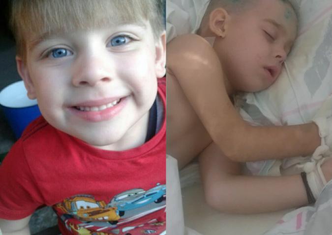 Un copil de 5 anișori suferă de tumoare malignă pe creier. Părinții disperați strigă după ajutor