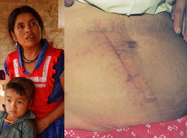 O femeie din Mexic singură și-a făcut cezariană și a rămas în viață! Singura persoană căreia i-a reușit acest lucru