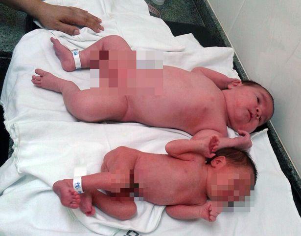 O mamă a născut o fetiță de aproape 6 kg