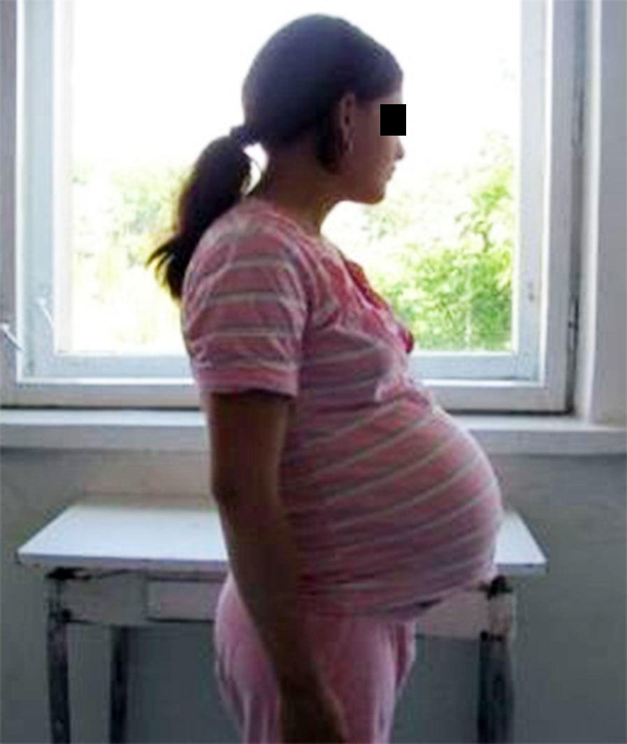 A rămas însărcinată la 16 ani, chiar dacă era virgină!