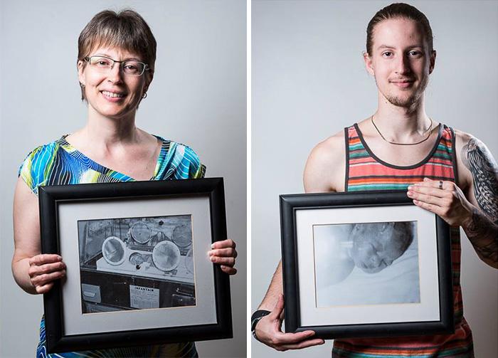 До и после: фотографии детей, которые родились раньше срока