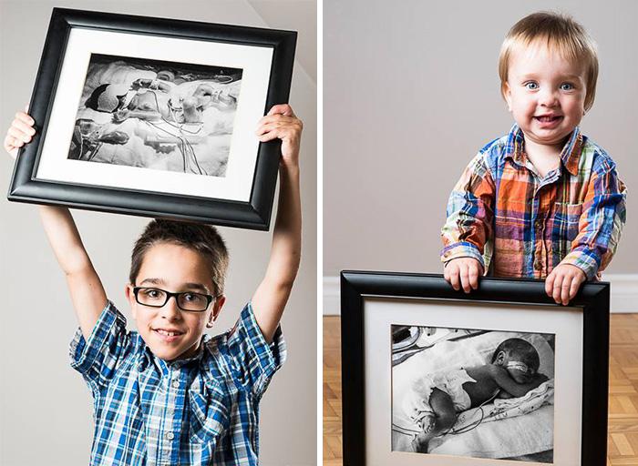 Înainte și după: fotografii ale copiilor care s-au născut prematur