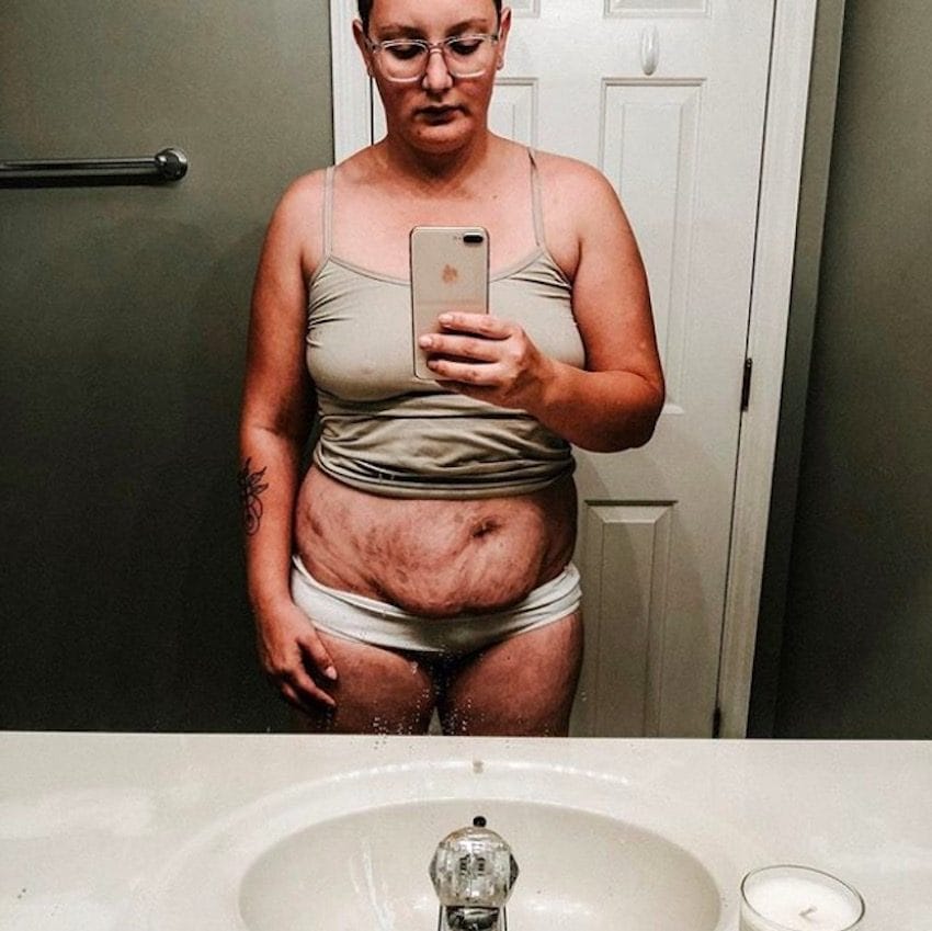 O femeie și-a arătat burta după 10 nașteri