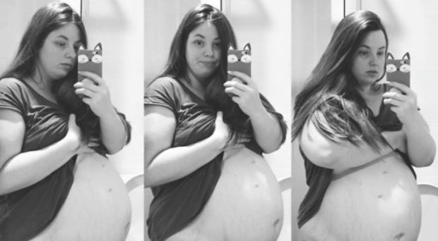 Беременная в 4-й раз женщина понимала, что такого с ее животом быть не должно