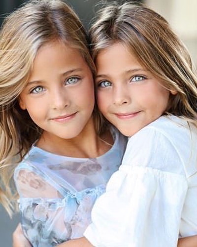 Как выглядят самые красивые близнецы в мире!