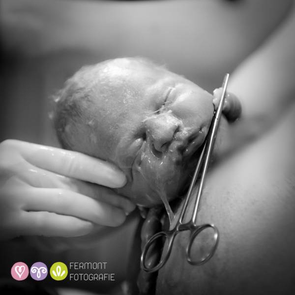 Colecția de fotografii fascinante care surprind momentul când capul bebelușului apare pe lume!