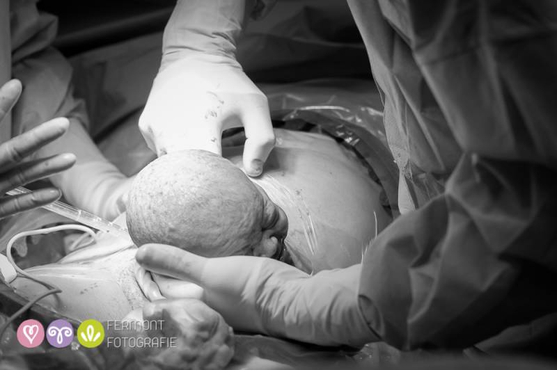 Colecția de fotografii fascinante care surprind momentul când capul bebelușului apare pe lume!