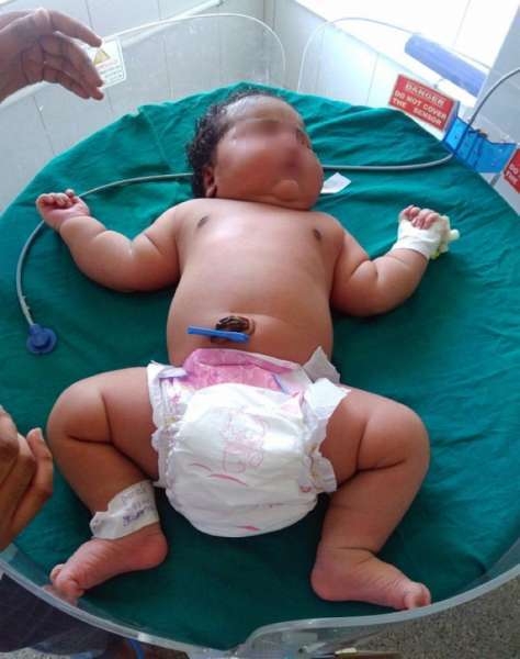 В России родилась девочка с рекордным весом