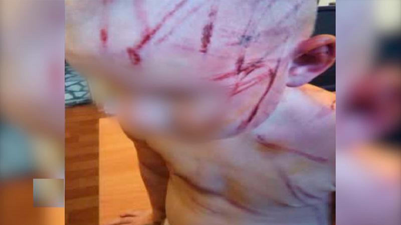 Imagini îngrozitoare: Și-a lovit fiica vitregă de doar patru ani cu încărcătorul de la telefon