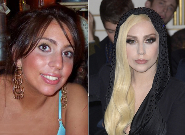 Какие пластические операции делали Дженнифер Лопес и Леди Гага