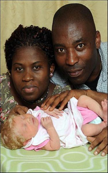 Сюрприз: у чернокожей пары родился белый ребенок