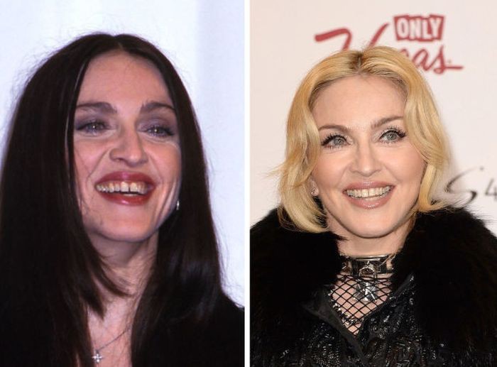 Улыбка на миллион: 20 примеров того, как зубы поменяли внешность знаменитых людей