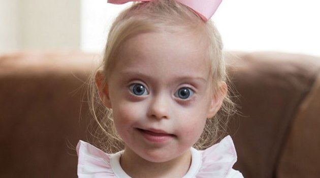 Двухлетняя девочка с синдромом Дауна стала моделью
