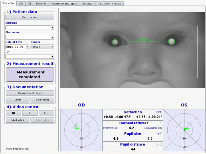 Examinarea oftalmologică cu PlusoptiX – pentru copii mici  și foarte mici!