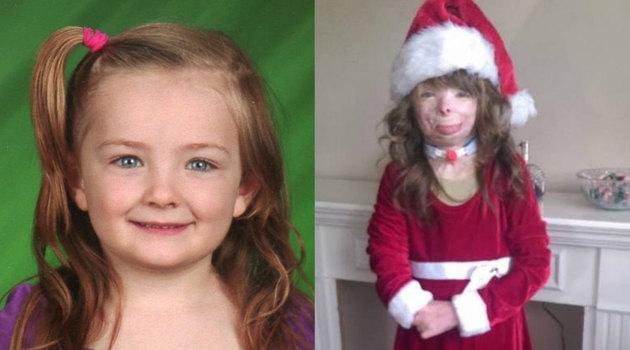 Девочка, потерявшая всю семью в пожаре, просит прислать ей открытку на Рождество