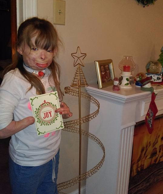 Девочка, потерявшая всю семью в пожаре, просит прислать ей открытку на Рождество