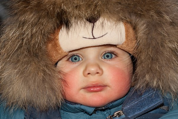Детская аллергия на холод. Интервью со специалистом Джеоржетой Руссу