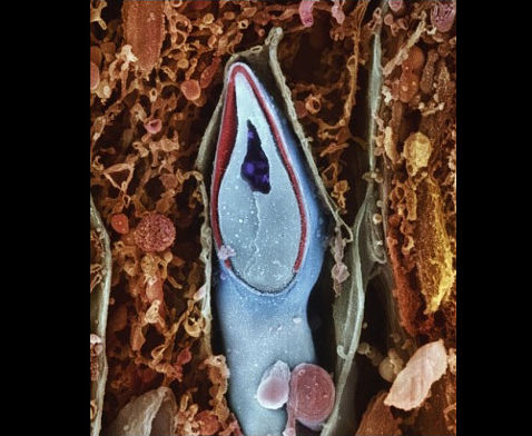 Уникальный фоторепортаж из глубин женского тела: как зарождается жизнь