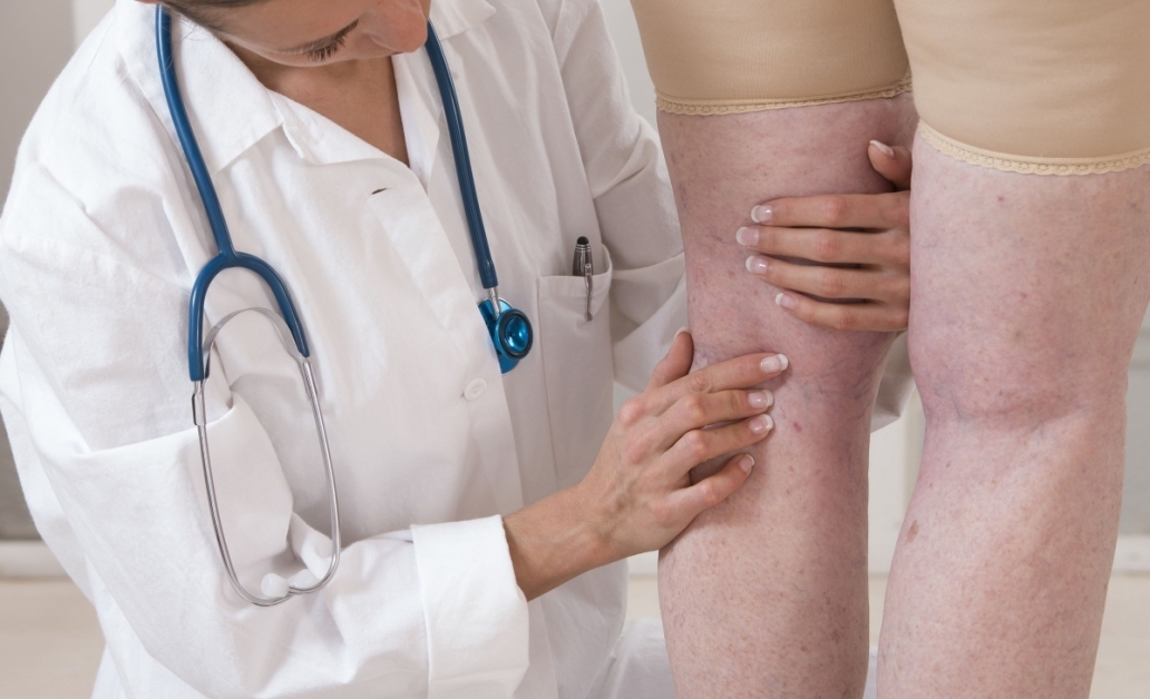 varicoza este tratată care doctor varicoza durerii sub genunchi