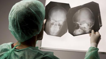 Черепно-мозговые травмы портят отношения между ребенком и родителями