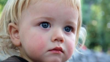 Erupțiile cutanate de pe corpul copiilor