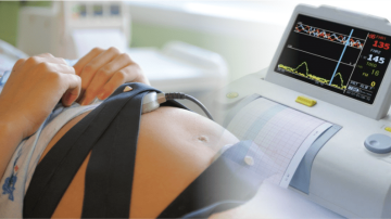 Evaluarea stării fătului în timpul nașterii