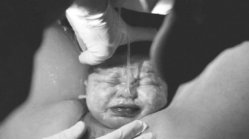 Instagram заблокировал фото появления младенца на свет