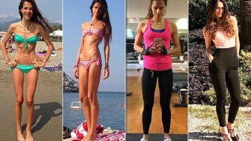 Страдающая от анорексии итальянка вылечилась благодаря Instagram