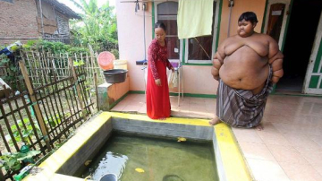 В Индонезии «самого полного в мире ребенка» посадили на диету