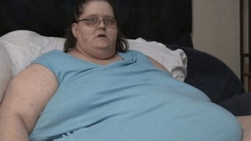 В Австралии женщина весом 272 кг родила 18-килограммового ребёнка