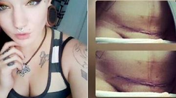 "А, кесарево сечение. Да тебе даже не пришлось рожать!" - эти слова возмутили молодую маму