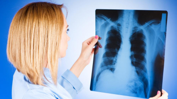 Numărul bolnavilor de tuberculoză diagnosticaţi tardiv creşte în ţara noastră