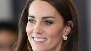 Нос Кейт Миддлтон — хит пластической хирургии в Британии