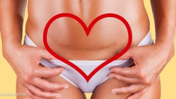 Эту правду знают только матери, которые пережили кесарево