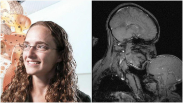Материнскую любовь запечатлели на МРТ