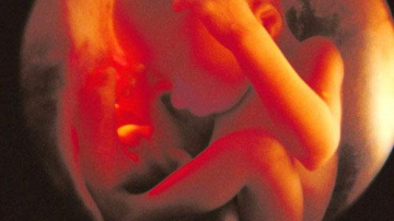 Culoarea lichidului amniotic: ce semnifică aceasta?